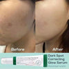 Axis Y Dark Spot Correcting Glow Serum x 24 pieces