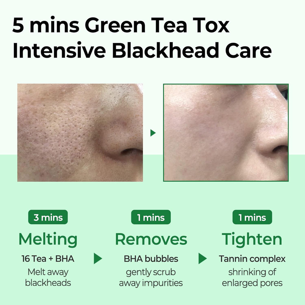 Some By Mi Bye Bye Blackhead 30 Days Miracle Green Tea Tox Bubble Cleanser x24 pieces