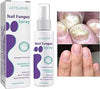 Nail Fungus Spray x24 pieces