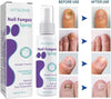 Nail Fungus Spray x24 pieces