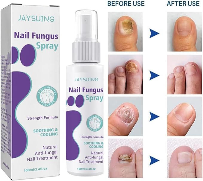 Nail Fungus Spray x24 pieces