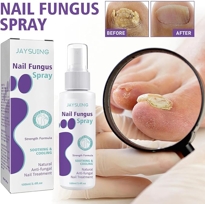 Nail Fungus Spray x24 pieces