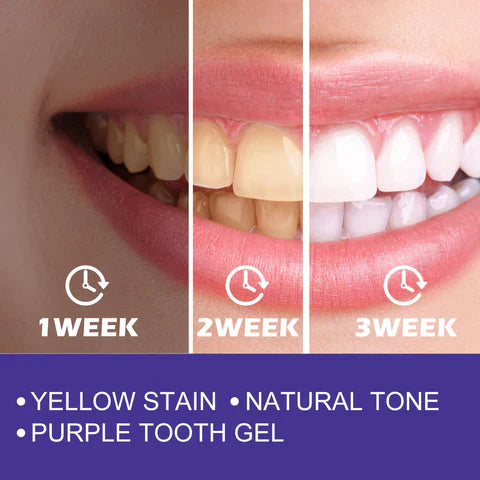 EELHOE Purple Teeth Whitening Toothpaste, Removes Stains